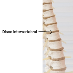 Columna vertebral y disco intervertebral