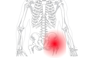 Cadera en resorte y osteopatía