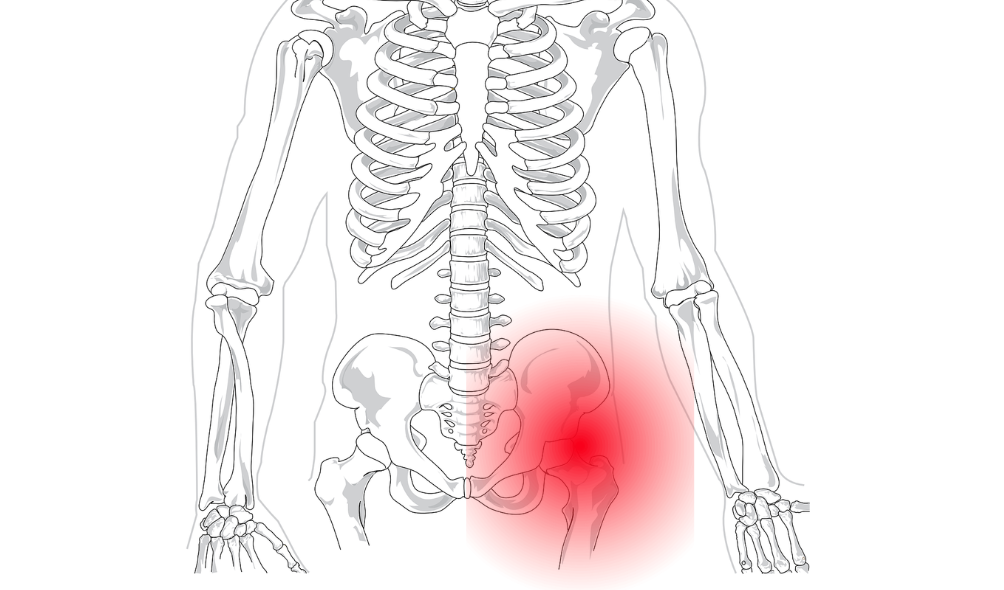 Tratamientos de osteopatía para casos de cadera en resorte