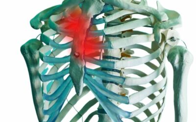Costocondritis costal y osteopatía